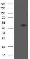 PHKG2 Antibody (clone OTI2A3)