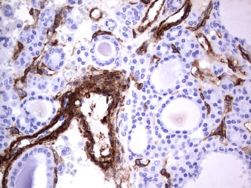 Monoclonal Mouse anti-Human MCAM / CD146 Antibody (clone UMAB154, Carrier-free, IHC, WB)