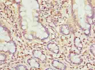 Polyclonal Rabbit anti-Human MRPL51 Antibody (IHC, WB)