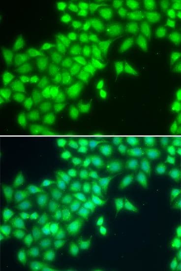 METTL2A Antibody