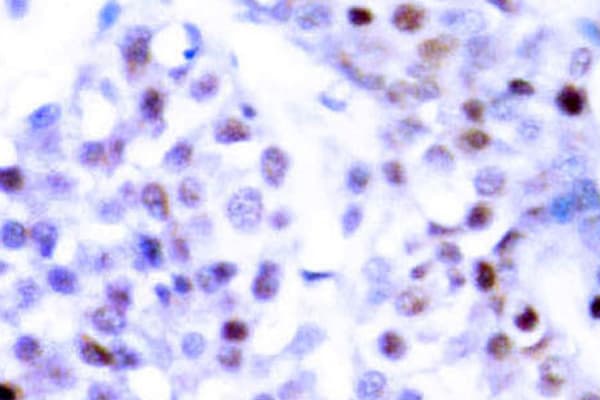 Polyclonal Rabbit anti-Human STAT6 Antibody (Arg639, IHC, WB)