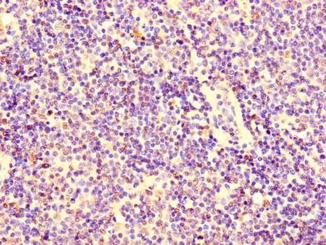 KPNA2 / Importin Alpha 1 Antibody
