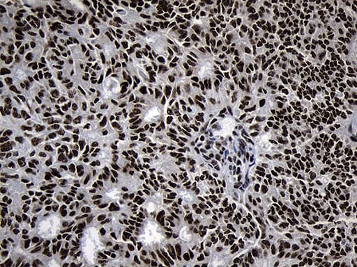 POLR2A / RNA polymerase II Antibody (aa1351-1614, clone OTI2B7)