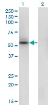 IHC-plus™ SHMT / SHMT1 Antibody (clone 4F9)