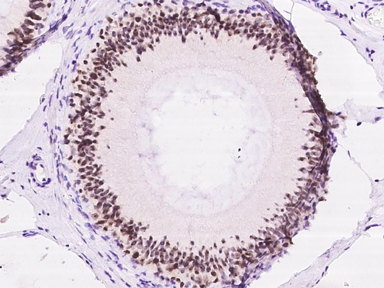 Polyclonal Rabbit anti-Human PHF6 Antibody (IHC)