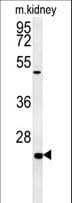 SHISA2 Antibody (aa259-288)