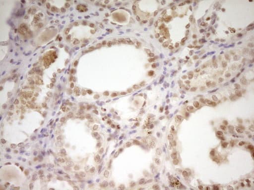 NR2C2 / TAK1 Antibody (aa1-241, clone OTI1F3)
