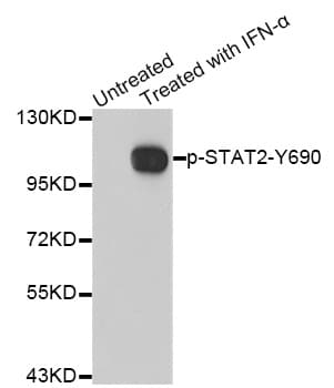 STAT2 Antibody (phospho-Tyr690)