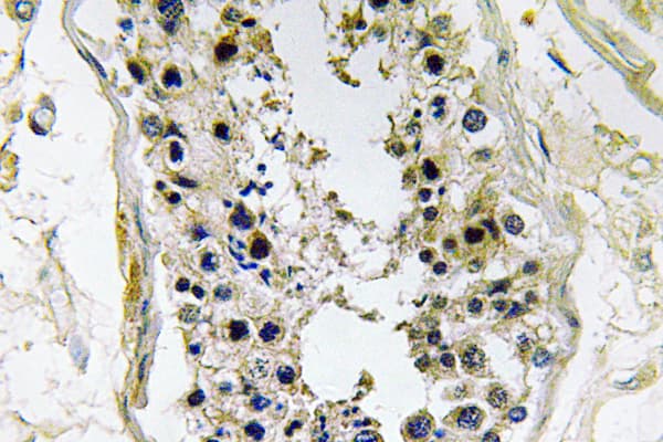 Polyclonal Rabbit anti-Human BMP8B Antibody (aa41-90, IHC)