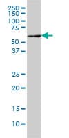 IHC-plus™ IRAK2 / IRAK-2 Antibody (clone 6C7)
