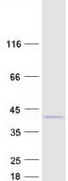Human C11orf49 Protein (Recombinant Myc-DDK (Flag))