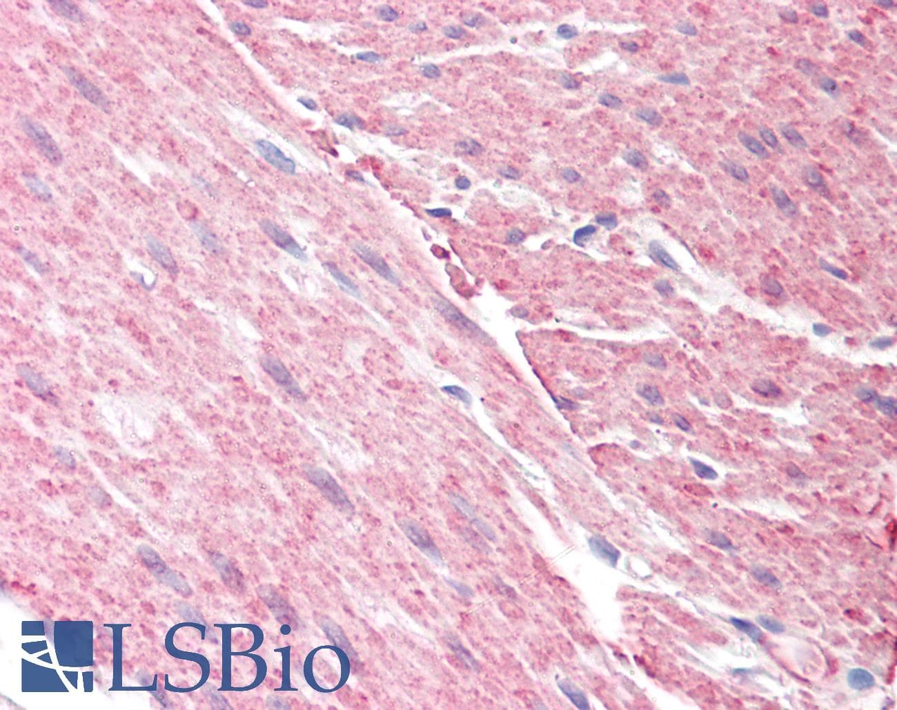 IHC-plus™ ARHGAP26 / GRAF Antibody (aa747-759)