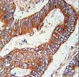 KLHL6 Antibody (aa543-571)