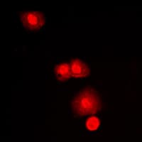 MTOR Antibody (C-Terminus)
