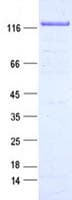 Human RBM10 Protein (Recombinant DDK,C-terminus)