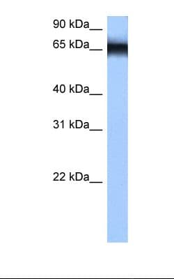 HNRPM / HNRNPM Antibody (N-Terminus, FITC)