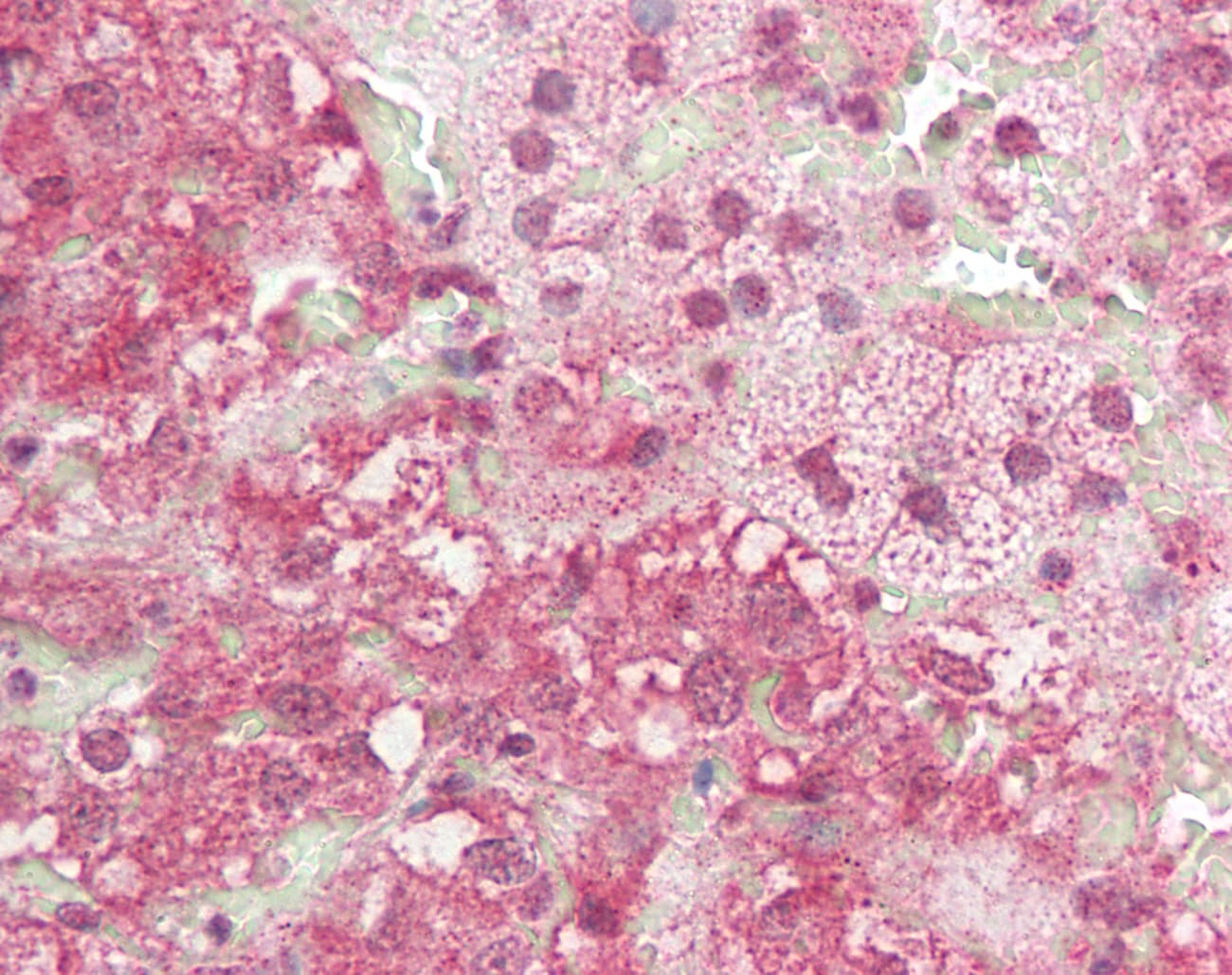 IHC-plus™ TRIM21 / RO52 Antibody