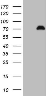 Monoclonal Mouse anti-Human SPP1 / Osteopontin Antibody (clone OTI2F2, aa17-314, IHC, WB)