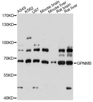 Polyclonal Rabbit anti-Human GPNMB / Osteoactivin Antibody (WB)