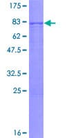 Human BMP3 Protein (Recombinant GST)