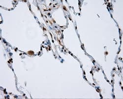NPR3 Antibody (clone OTI4C3)