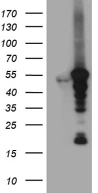 VRK2 Antibody (aa301-486, clone OTI8H5)