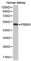 Polyclonal Rabbit anti-Human PSEN1 / Presenilin 1 Antibody (IHC, WB)