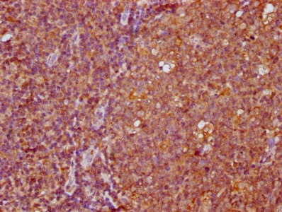 Polyclonal Rabbit anti-Human FAM83G Antibody (IHC)