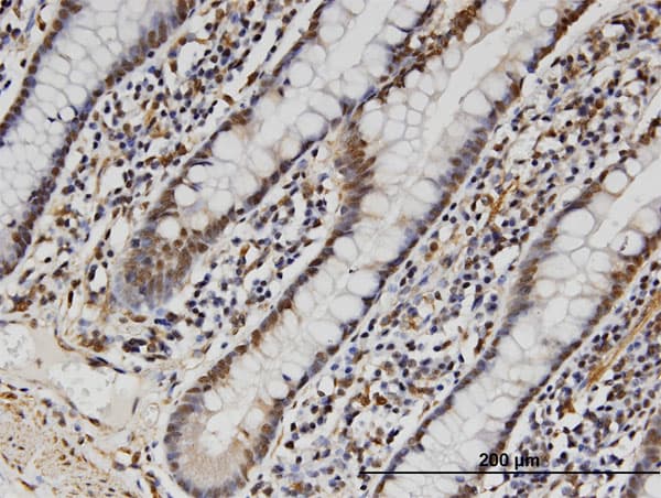 Monoclonal Mouse anti-Human FAM3B Antibody (clone 1E7, IHC, WB)