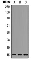 MCFD2 Antibody (N-Terminus)