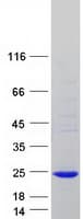 Human IFT22 / RABL5 Protein (Recombinant Myc-DDK (Flag))