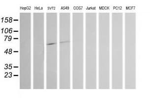 CHGA / Chromogranin A Antibody (clone OTI2E12)