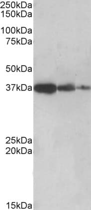 IHC-plus™ PPP2R4 Antibody (aa347-358)