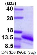 Human VOPP1 / ECOP Protein (Recombinant His)