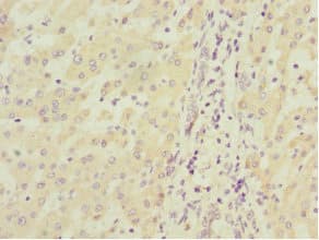 MGLL / Monoacylglycerol Lipase Antibody
