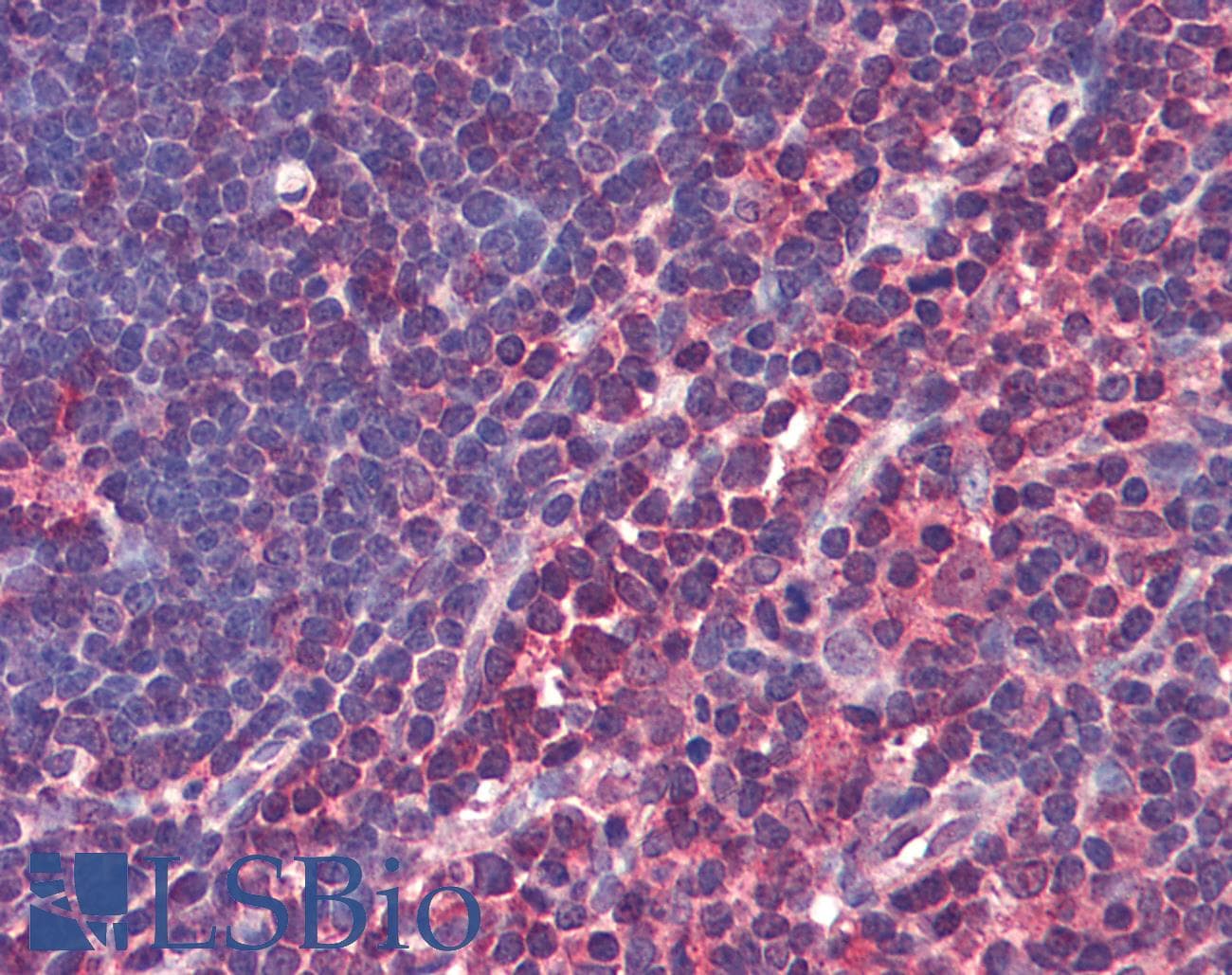 IHC-plus™ CASP4 / Caspase 4 Antibody