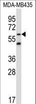 ZNF479 Antibody (aa115-144)