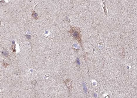 IGFBP3 Antibody (phospho-Ser183)