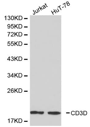Polyclonal Rabbit anti-Human CD3D Antibody (IHC, WB)