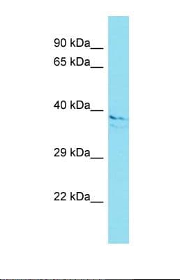 Polyclonal Rabbit anti-Human SLAIN1 Antibody (aa170-219, WB)