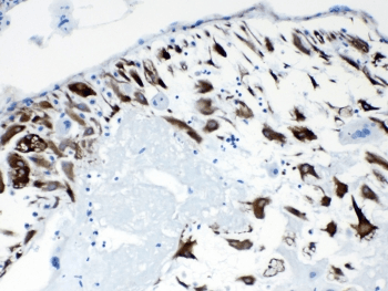 Polyclonal Rabbit anti-Human PPP1R14A / CPI-17 Antibody (IHC, WB)