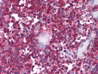 Monoclonal Mouse anti-Human CD247 / CD3 Zeta Antibody (clone 4B10, IHC, IF, WB)