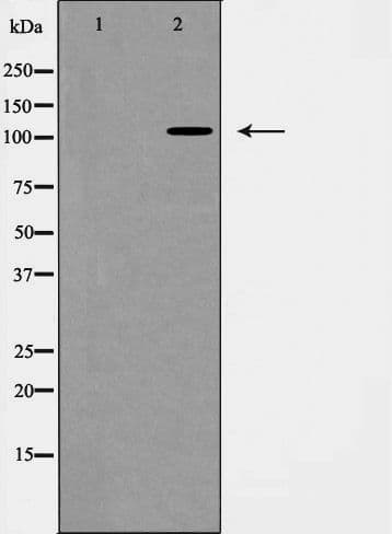 Polyclonal Rabbit anti-Human BMPR2 Antibody (IF, WB)