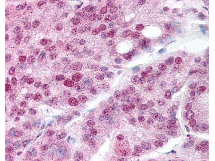 HSP90AA1 / Hsp90 Alpha A1 Antibody (K294)