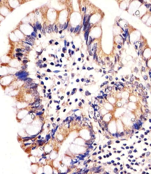 CARD6 Antibody