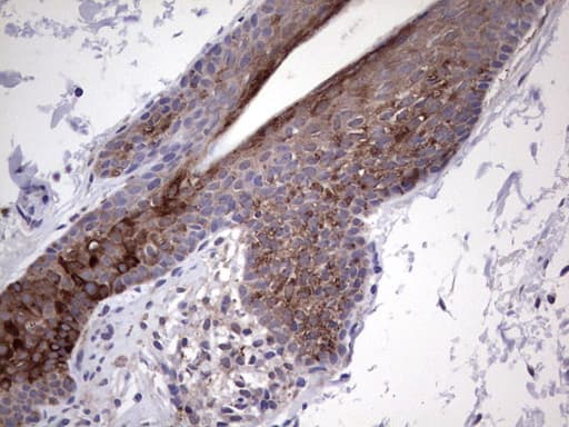 GLI2 Antibody (aa729-1123, clone OTI1F9)