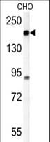 ATP11C Antibody (aa589-616)
