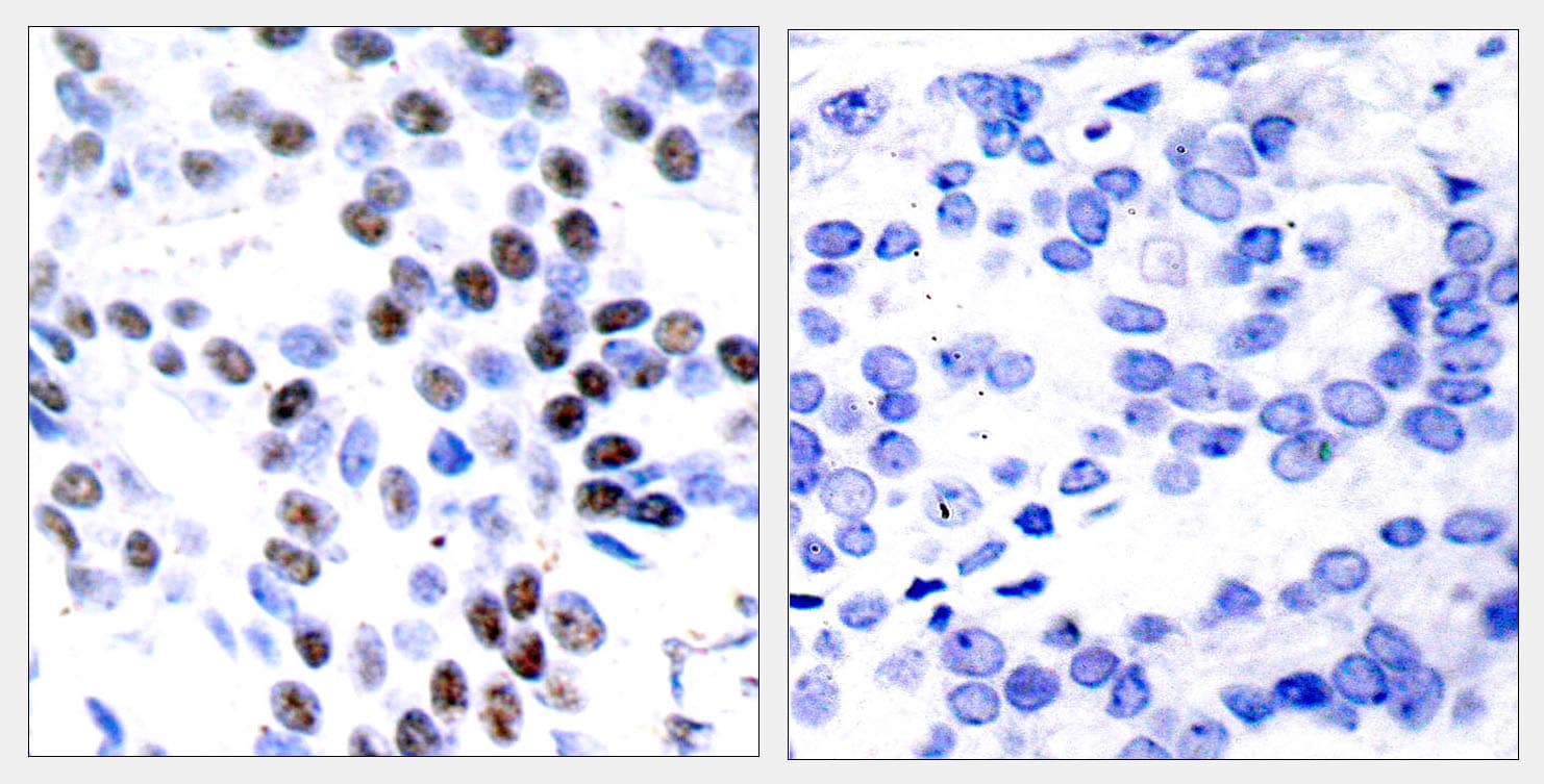 JUN / c-Jun Antibody (aa61-110)