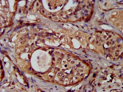 Polyclonal Rabbit anti-Human NUMBLIKE / NUMBL Antibody (IHC, IF)
