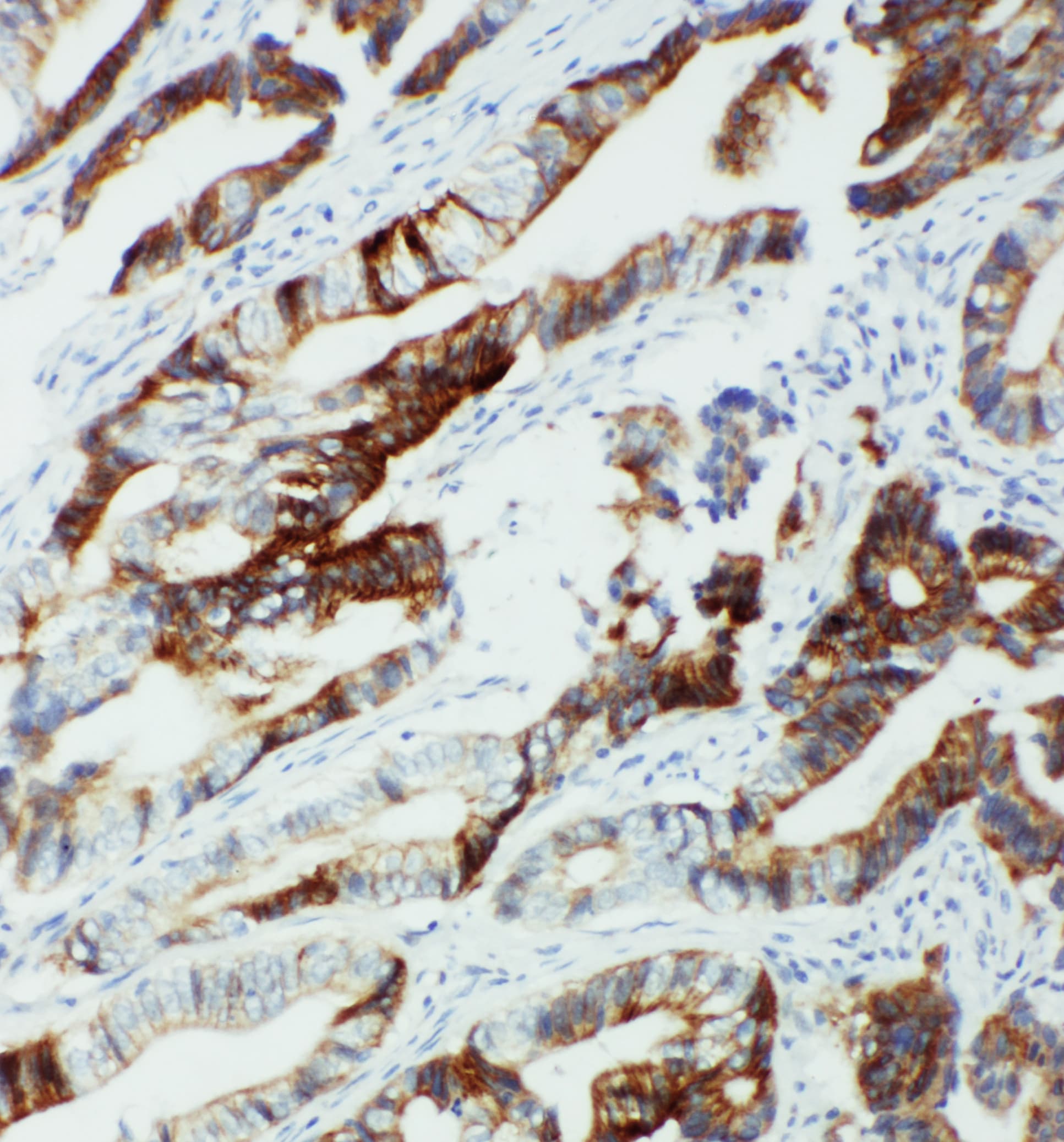 Polyclonal Rabbit anti-Human CYP2U1 Antibody (aa457-473, IHC, WB)